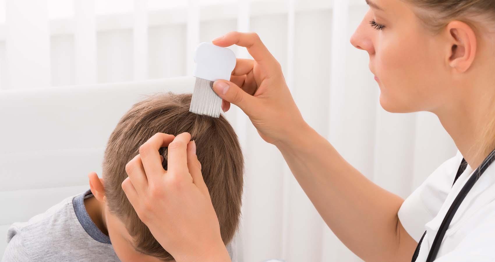 Lice - Tips for Camps | American Camp Association Lice - Tips for Camps | American Camp Association
